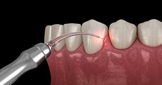 Cosmetic Dentistry