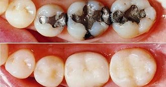 Emergency Dentistry