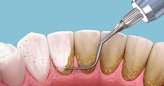Restorative Dentistry