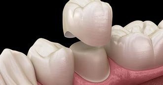 Family Dentistry