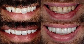 Restorative Dentistry
