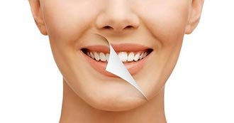 Preventive Dentistry