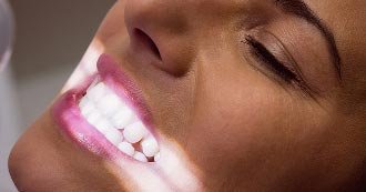 Teeth Whitening