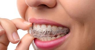 Preventive Dentistry