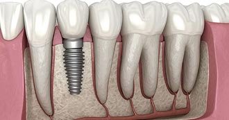 Preventive Dentistry