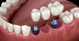 Cosmetic Dentistry