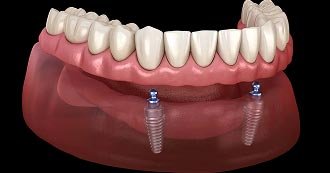 Restorative Dentistry