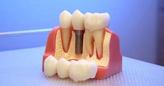Preventive Dentistry