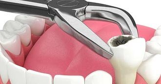 Emergency Dentistry