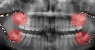 Family Dentistry