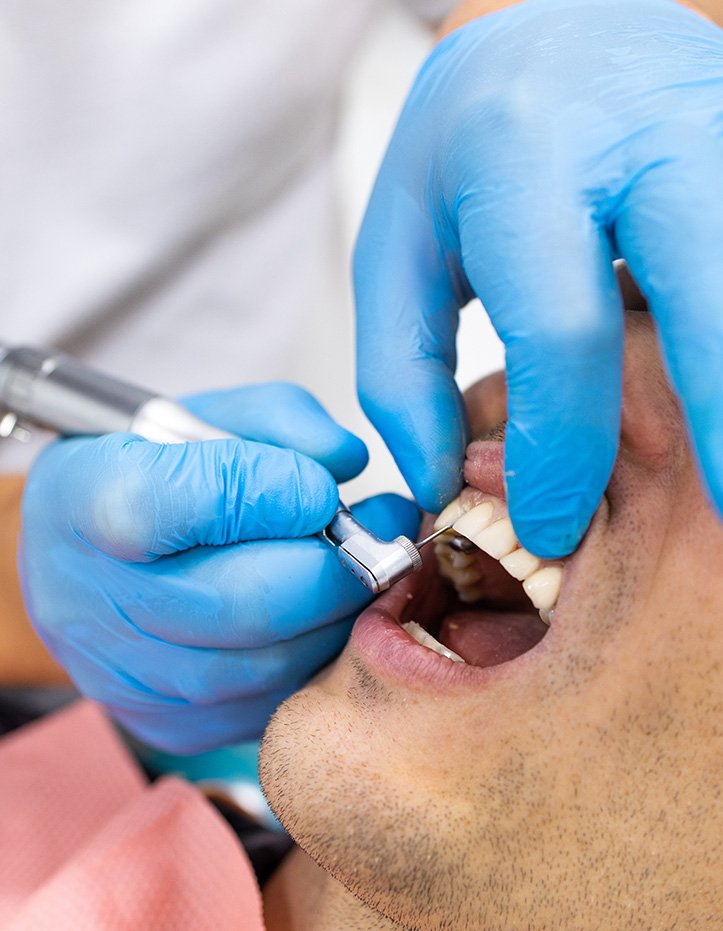 Close-up of a dental professional using a scaler near a patient’s gumline